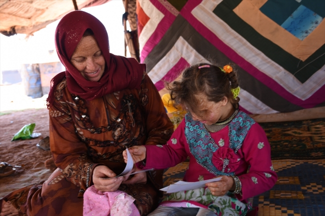 Yanık izleri nedeniyle dışlanan Suriyeli çocuk tedavi olmak istiyor