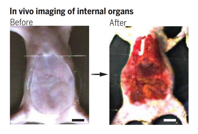 Organların önce (before) ve sonraki (after) görüntüleri